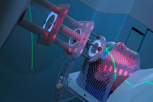 kanser tedavisi