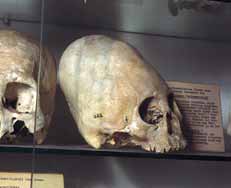 ecuador-skull.jpg