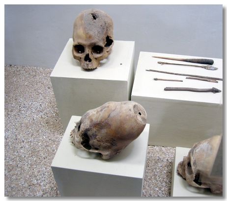 skull-paracas-2.jpg